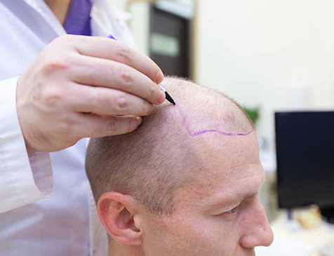 Slider image (3) Biruni Hair Institute